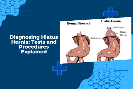 Diagnosing Hiatus Hernia: Tests and Procedures Explained