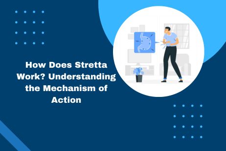 How Does Stretta Work? Understanding the Mechanism of Action