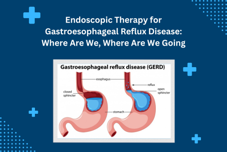 Endoscopic Therapy for Gastroesophageal Reflux Disease: Where Are We, Where Are We Going
