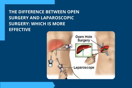 The difference between open surgery and laparoscopic surgery Which is more effective