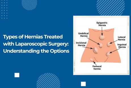 Types of Hernias Treated with Laparoscopic Surgery: Understanding the Options
