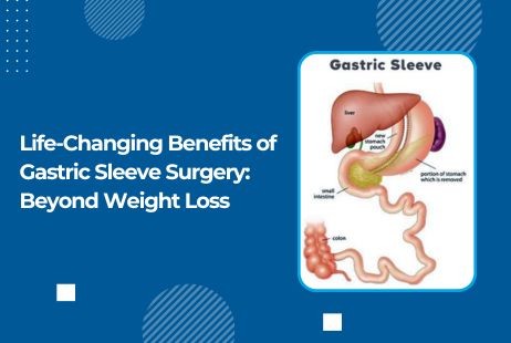Life-Changing Benefits of Gastric Sleeve Surgery: Beyond Weight Loss