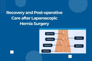Recovery and Post-operative Care after Laparoscopic Hernia Surgery
