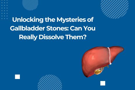 Unlocking the Mysteries of Gallbladder Stones: Can You Really Dissolve Them?